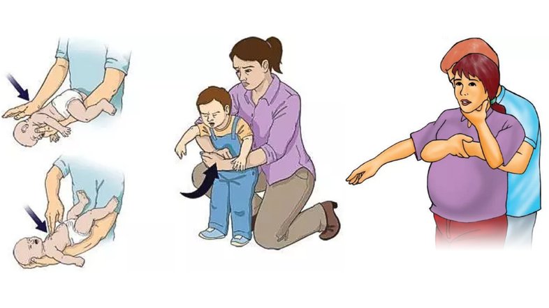 Ilustrações do guia que traz dicas de como lidar com casos de engasgo